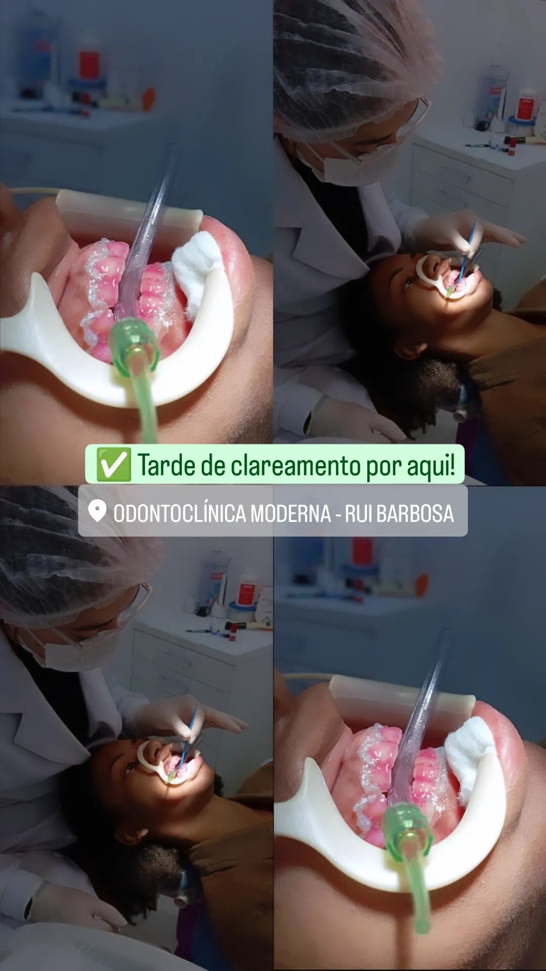Clareamento Dental